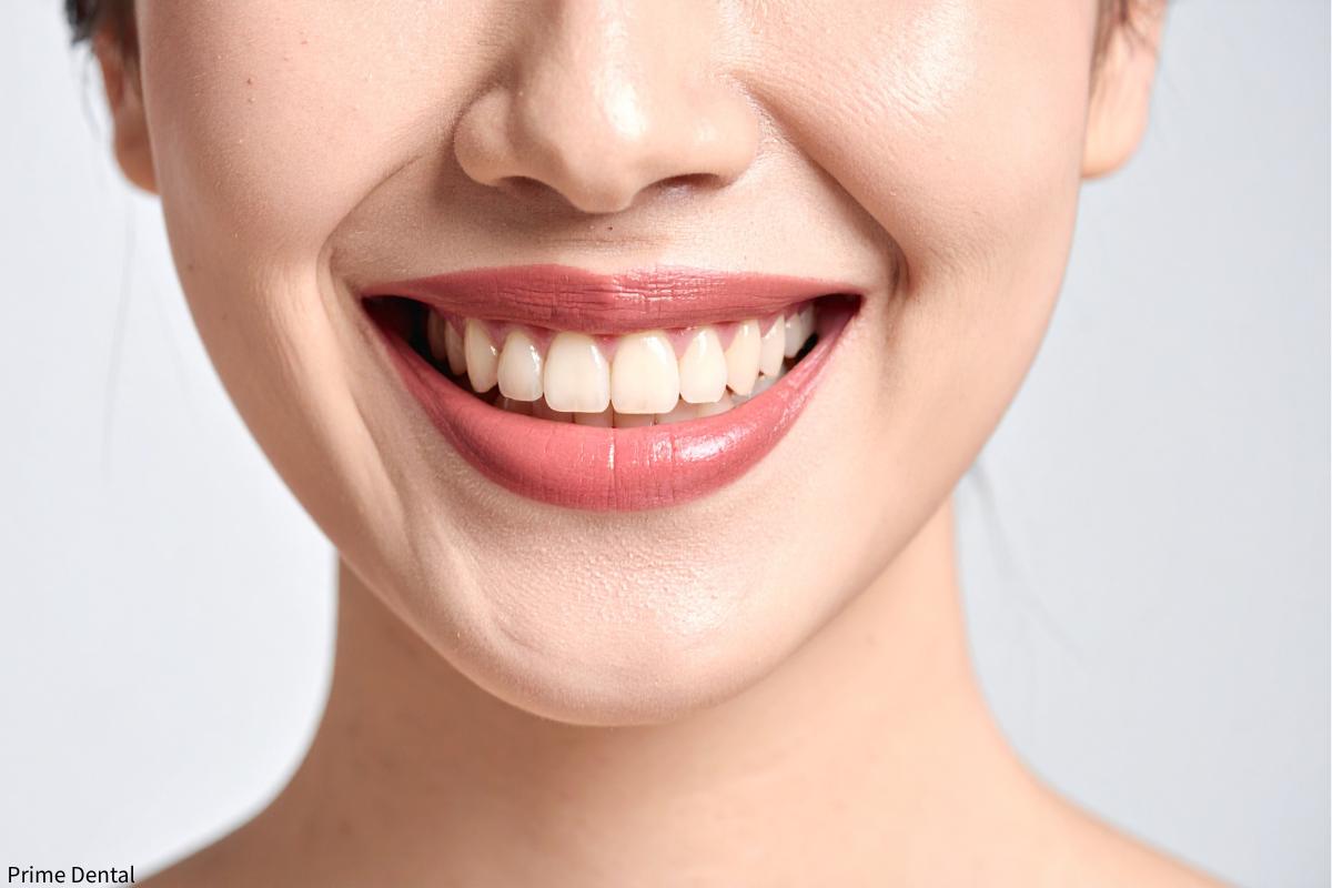 wisdom teeth removal Coquitlam