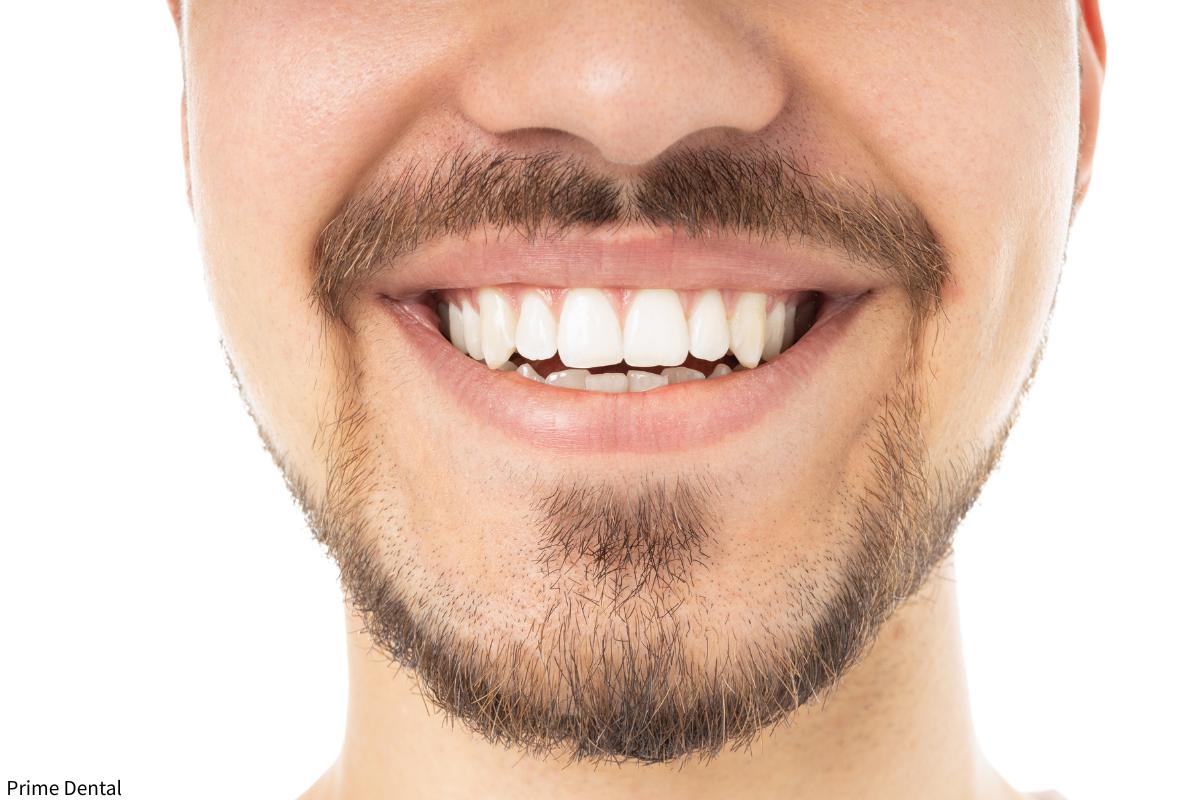 missing teeth treatment Coquitlam